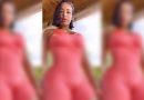 Beautiful & Adorable – Pretty lady share a swollen piece of her flesh – [Photos]